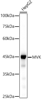MVK Rabbit Monoclonal Antibody