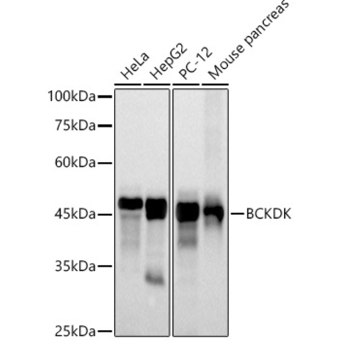 BCKDK Rabbit Monoclonal Antibody