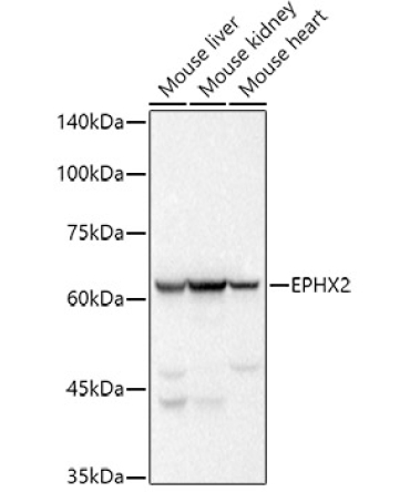 EPHX2 Rabbit Monoclonal Antibody