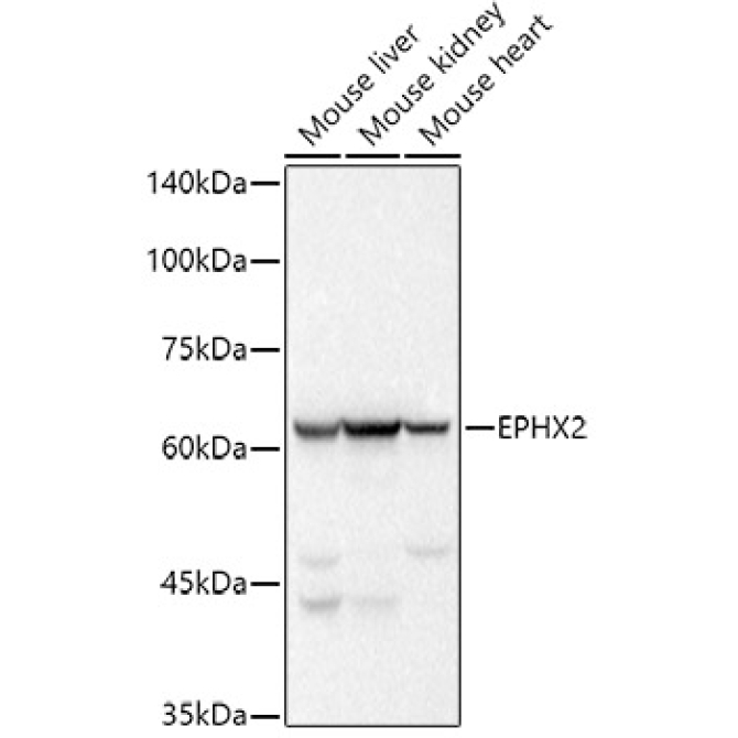 EPHX2 Rabbit Monoclonal Antibody
