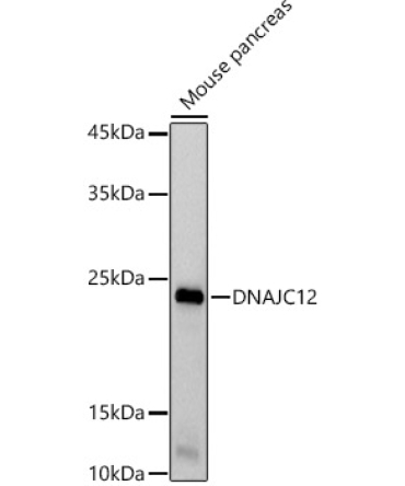 DNAJC12 Rabbit Monoclonal Antibody