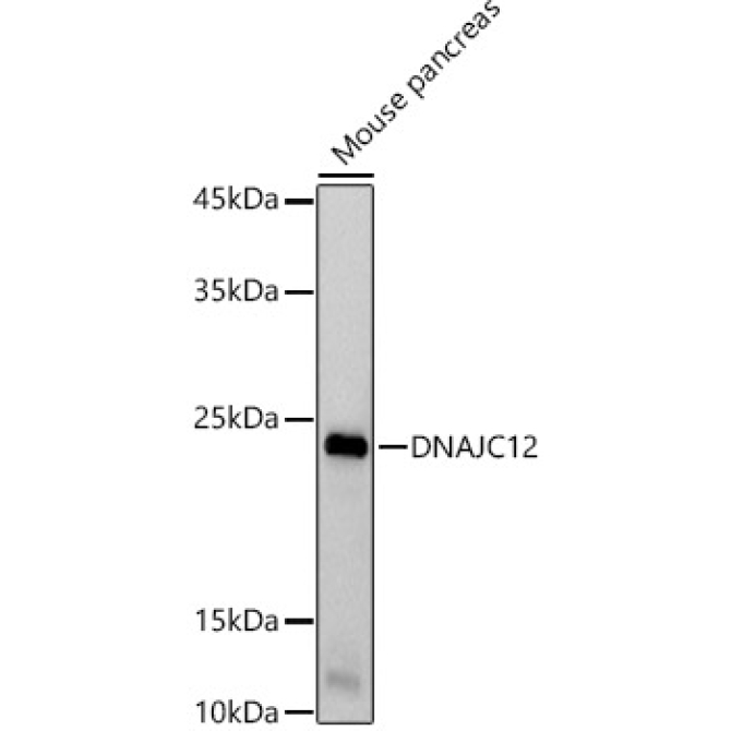 DNAJC12 Rabbit Monoclonal Antibody