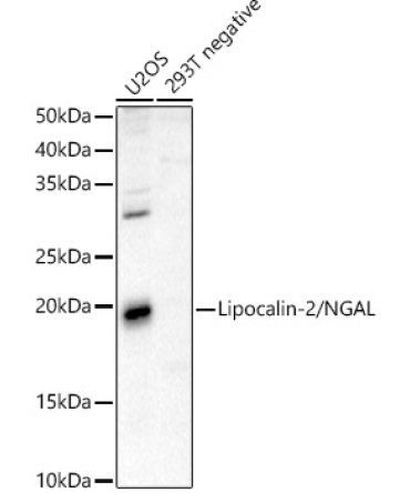 Lipocalin-2/NGAL Rabbit Polyclonal Antibody