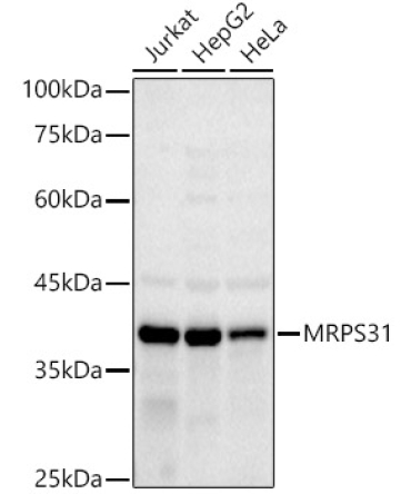 MRPS31 Rabbit Monoclonal Antibody