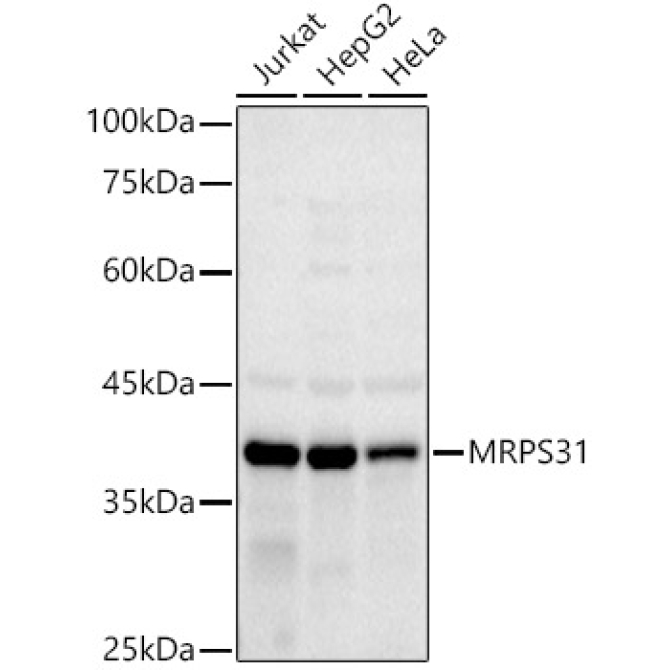 MRPS31 Rabbit Monoclonal Antibody