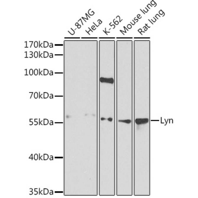 Lyn Rabbit Polyclonal Antibody