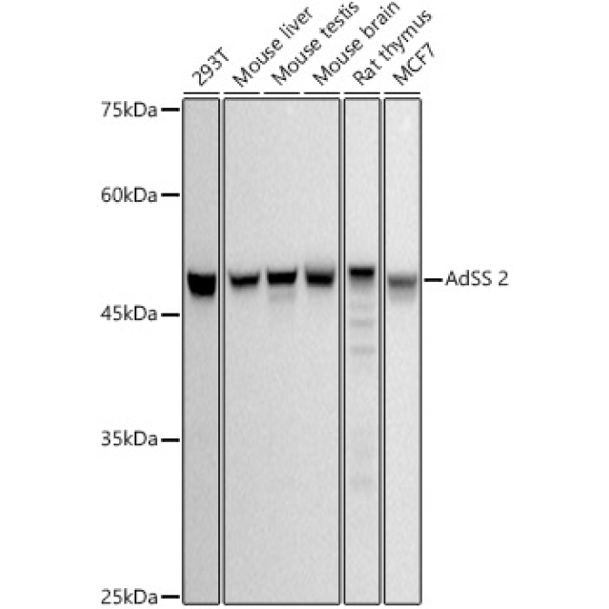 AdSS 2 Rabbit Monoclonal Antibody