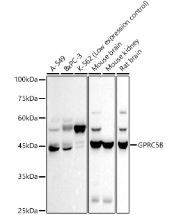 GPRC5B Rabbit Monoclonal Antibody