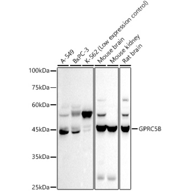 GPRC5B Rabbit Monoclonal Antibody