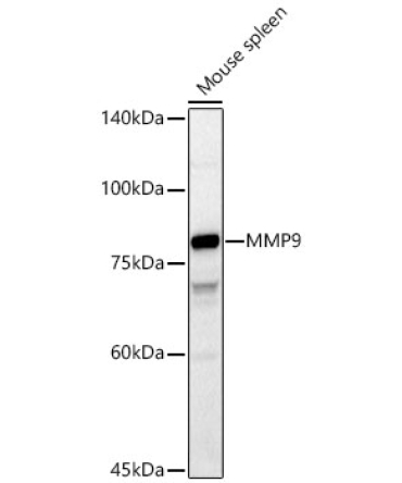 MMP9 Rabbit Polyclonal Antibody