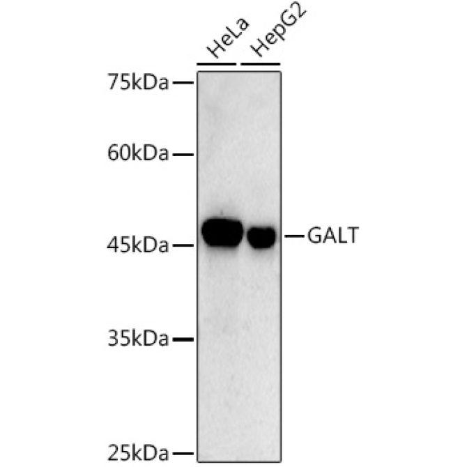 GALT Rabbit Monoclonal Antibody