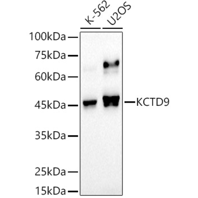 KCTD9 Rabbit Monoclonal Antibody