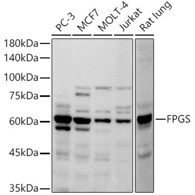 FPGS Rabbit Monoclonal Antibody