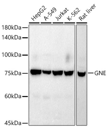 GNE Rabbit Monoclonal Antibody