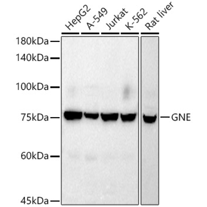 GNE Rabbit Monoclonal Antibody