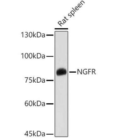 p75NTR/NGFR Rabbit Polyclonal Antibody