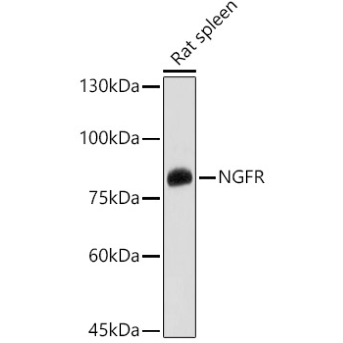 p75NTR/NGFR Rabbit Polyclonal Antibody