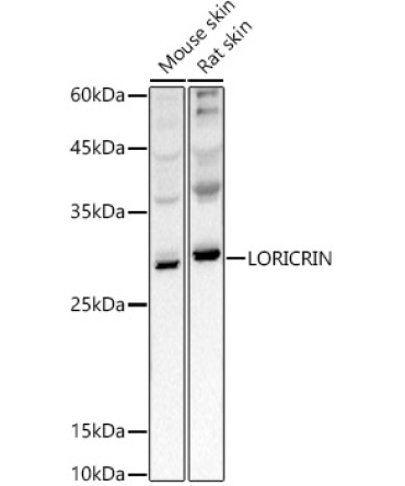 LORICRIN Rabbit Polyclonal Antibody