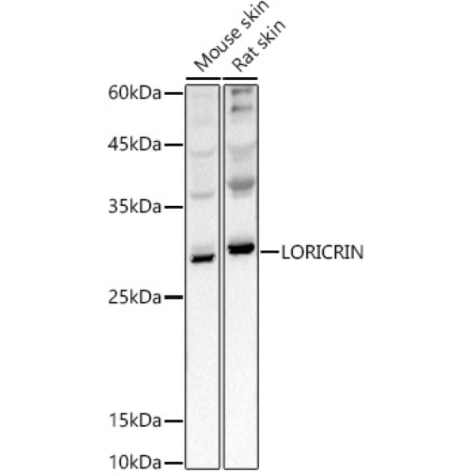 LORICRIN Rabbit Polyclonal Antibody