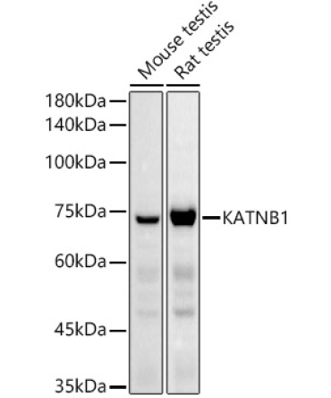 KATNB1 Rabbit Polyclonal Antibody