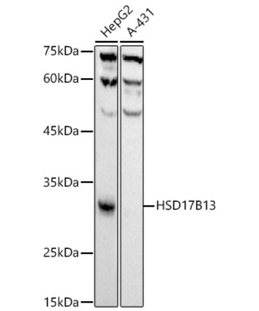 HSD17B13 Rabbit Monoclonal Antibody
