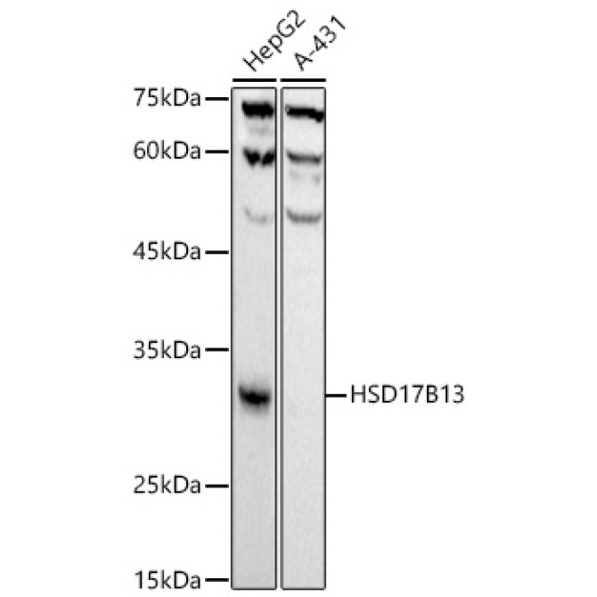 HSD17B13 Rabbit Monoclonal Antibody