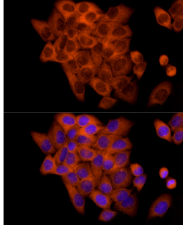 FRAT1 Rabbit Monoclonal Antibody