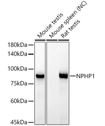 NPHP1 Rabbit Monoclonal Antibody