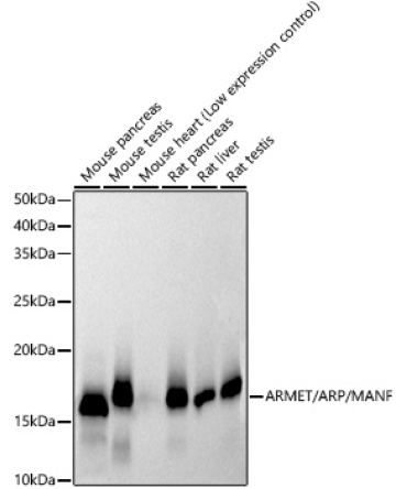 ARMET/ARP/MANF Rabbit Monoclonal Antibody