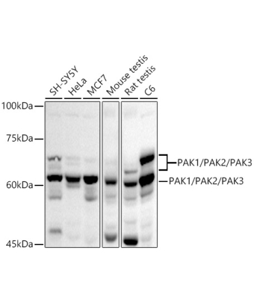 PAK1/PAK2/PAK3 Rabbit Polyclonal Antibody