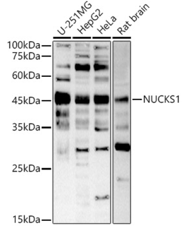 NUCKS1 Rabbit Polyclonal Antibody
