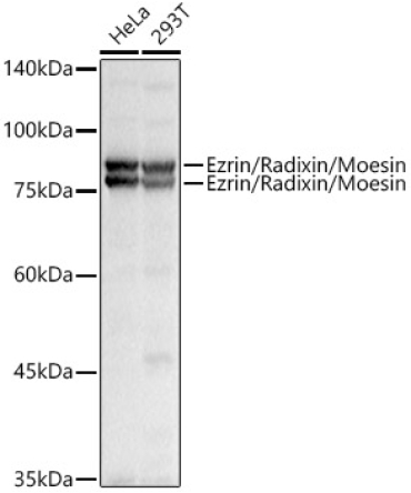 Ezrin/Radixin/Moesin Rabbit Polyclonal Antibody