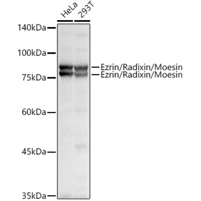 Ezrin/Radixin/Moesin Rabbit Polyclonal Antibody