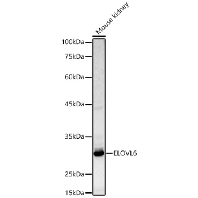 ELOVL6 Rabbit Polyclonal Antibody