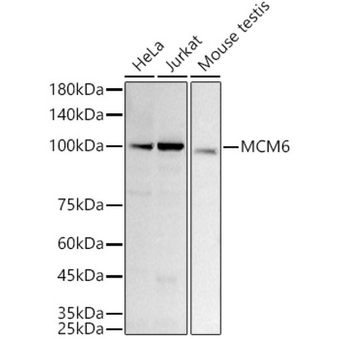 MCM6 Rabbit Monoclonal Antibody [KD Validated]