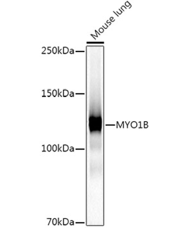 MYO1B Rabbit Monoclonal Antibody