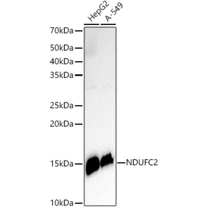 NDUFC2 Rabbit Monoclonal Antibody