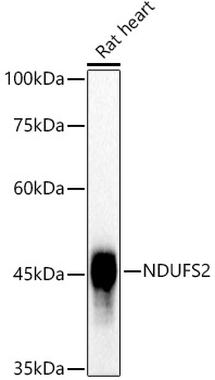 NDUFS2 Rabbit Monoclonal Antibody