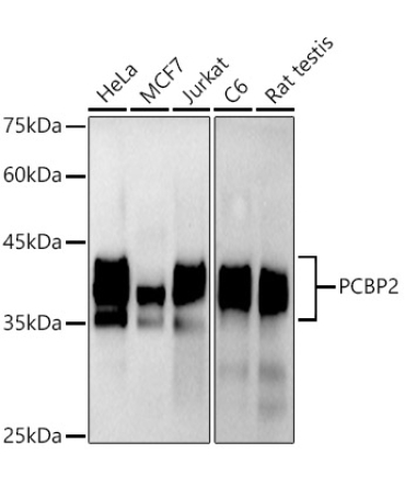 hnRNP E2/PCBP2 Rabbit Monoclonal Antibody