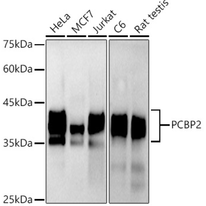 hnRNP E2/PCBP2 Rabbit Monoclonal Antibody