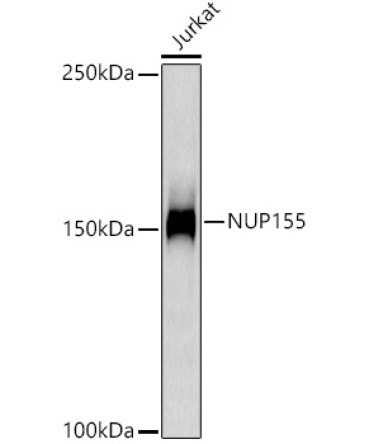 NUP155 Rabbit Monoclonal Antibody