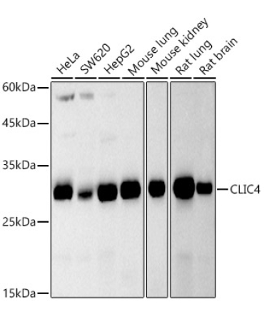CLIC4 Rabbit Monoclonal Antibody