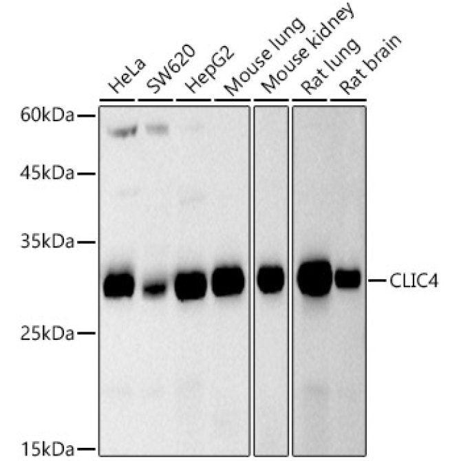 CLIC4 Rabbit Monoclonal Antibody