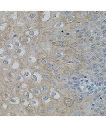 FAK Rabbit Polyclonal Antibody