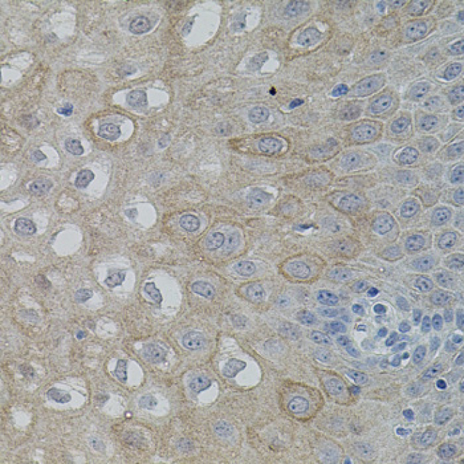 FAK Rabbit Polyclonal Antibody