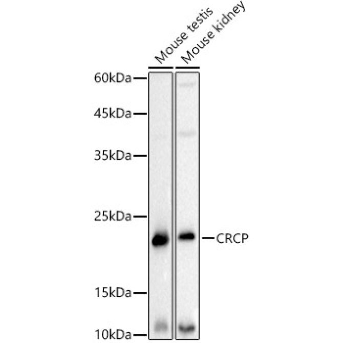 CRCP Rabbit Monoclonal Antibody