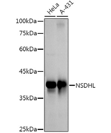 NSDHL Rabbit Monoclonal Antibody