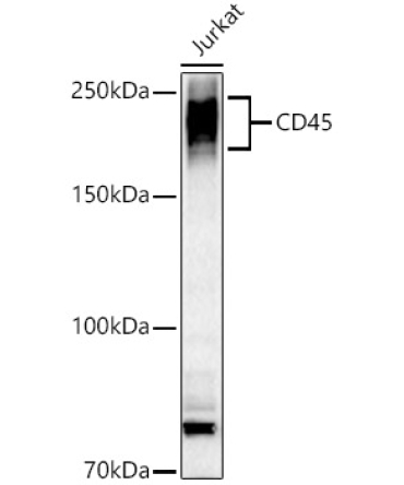 CD45 Rabbit Polyclonal Antibody
