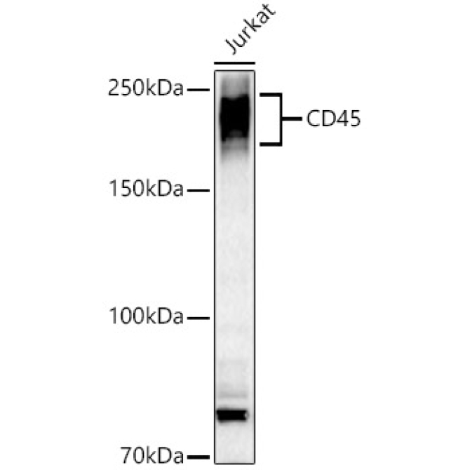 CD45 Rabbit Polyclonal Antibody