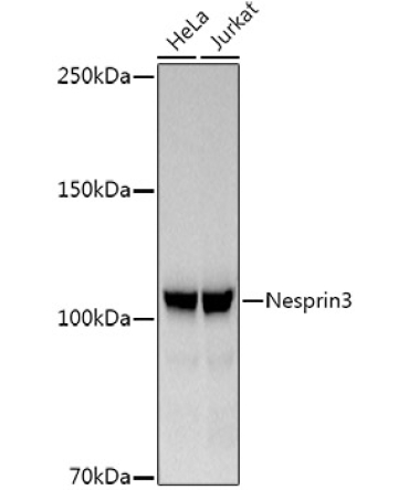 Nesprin3 Rabbit Monoclonal Antibody